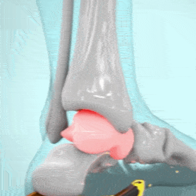 Branțuri pentru Pantofi cu Absorbție a Șocurilor